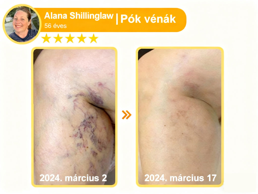 🔥𝐀𝐕𝐒𝐀𝐕𝐒™ 𝐌é𝐡𝐦é𝐫𝐞𝐠 𝐁ő𝐫𝐡𝐞𝐥𝐲𝐫𝐞á𝐥𝐥í𝐭ó 𝐊𝐫é𝐦 (👨‍⚕‍𝐂𝐄 𝐣ó𝐯á𝐡𝐚𝐠𝐲𝐨𝐭𝐭)