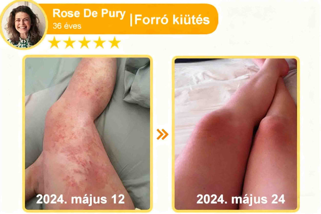 🔥𝐀𝐕𝐒𝐀𝐕𝐒™ 𝐌é𝐡𝐦é𝐫𝐞𝐠 𝐁ő𝐫𝐡𝐞𝐥𝐲𝐫𝐞á𝐥𝐥í𝐭ó 𝐊𝐫é𝐦 (👨‍⚕‍𝐂𝐄 𝐣ó𝐯á𝐡𝐚𝐠𝐲𝐨𝐭𝐭)