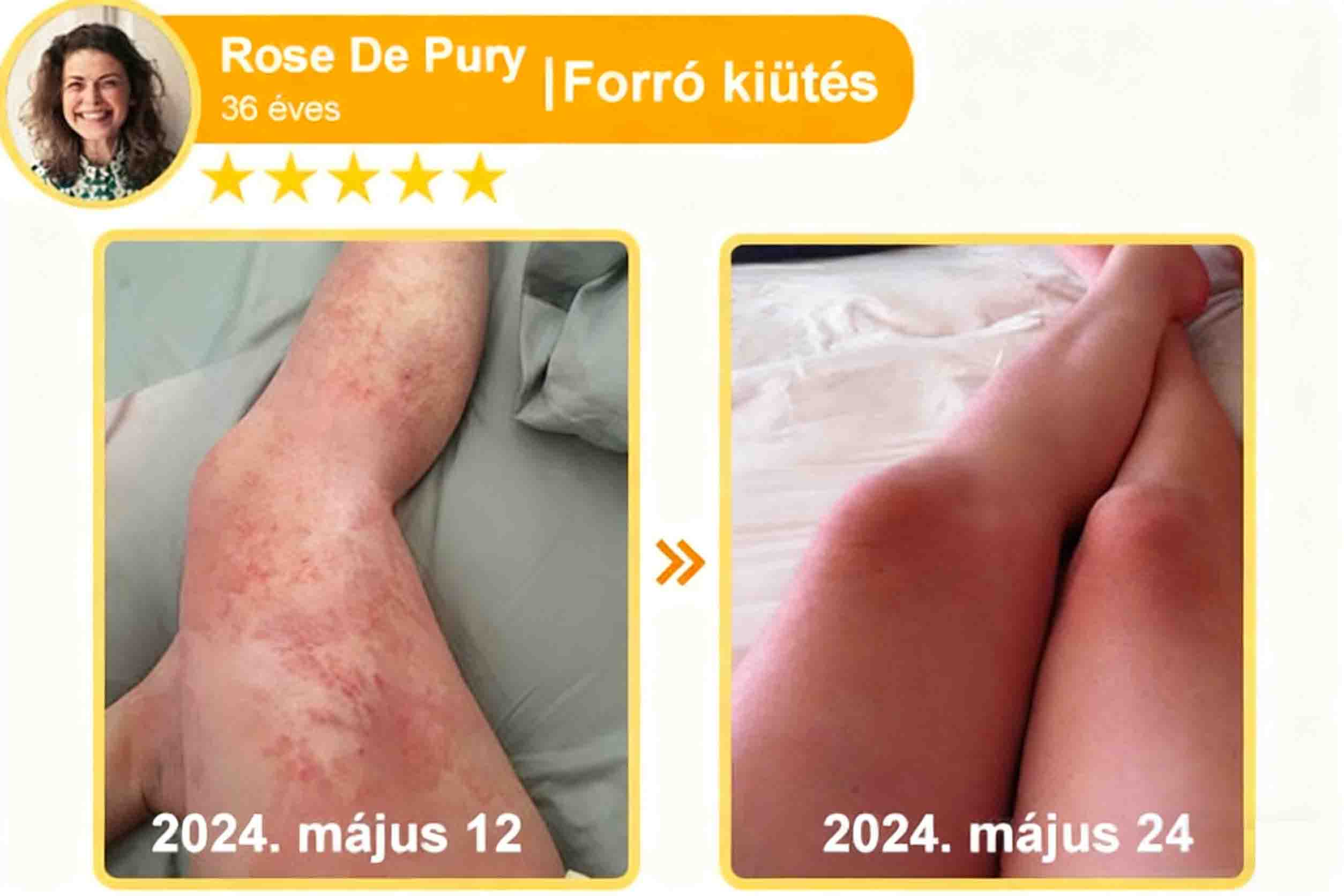 🔥𝐀𝐕𝐒𝐀𝐕𝐒™ 𝐌é𝐡𝐦é𝐫𝐞𝐠 𝐁ő𝐫𝐡𝐞𝐥𝐲𝐫𝐞á𝐥𝐥í𝐭ó 𝐊𝐫é𝐦 (👨‍⚕‍𝐂𝐄 𝐣ó𝐯á𝐡𝐚𝐠𝐲𝐨𝐭𝐭)