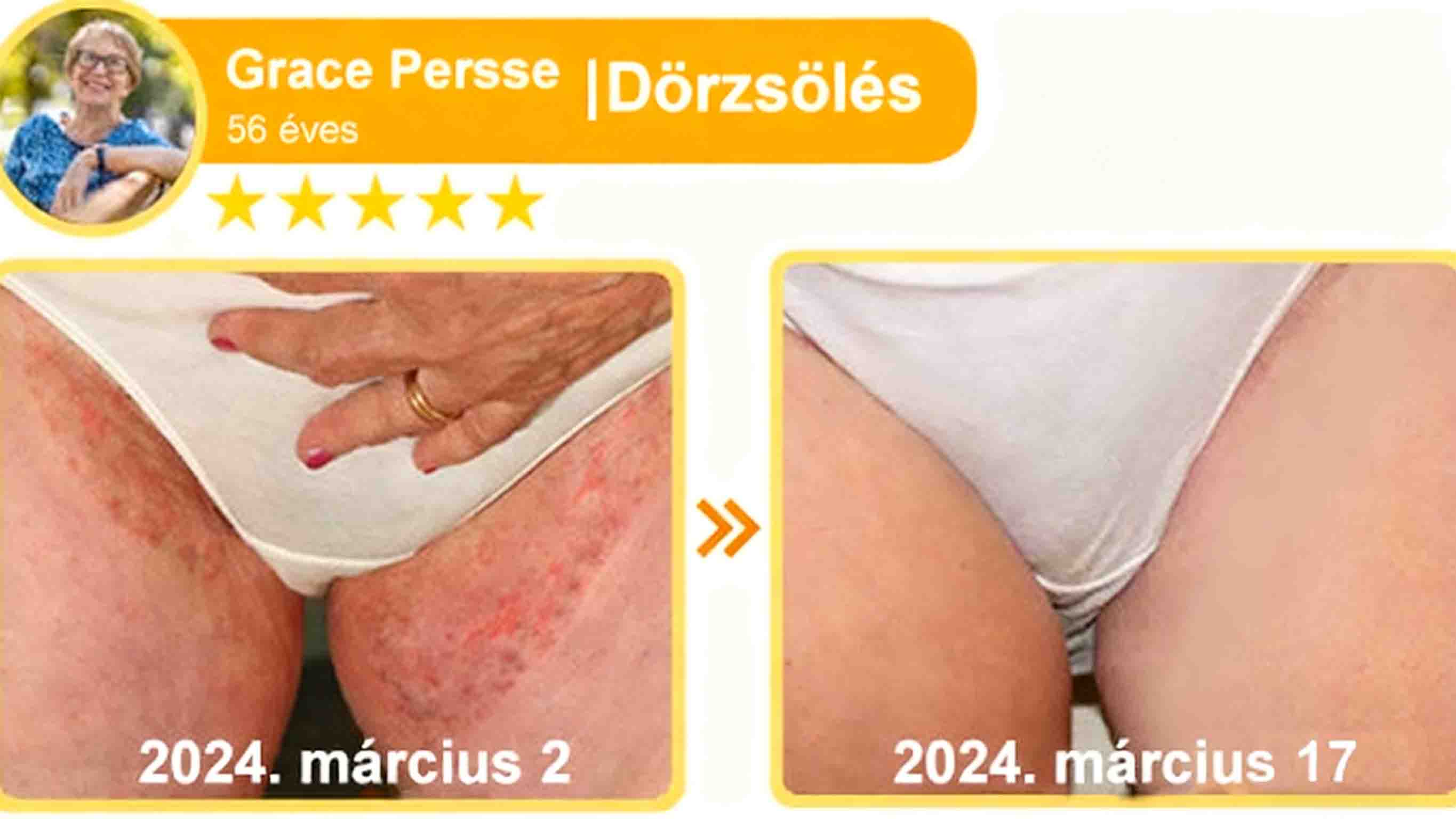 🔥𝐀𝐕𝐒𝐀𝐕𝐒™ 𝐌é𝐡𝐦é𝐫𝐞𝐠 𝐁ő𝐫𝐡𝐞𝐥𝐲𝐫𝐞á𝐥𝐥í𝐭ó 𝐊𝐫é𝐦 (👨‍⚕‍𝐂𝐄 𝐣ó𝐯á𝐡𝐚𝐠𝐲𝐨𝐭𝐭)