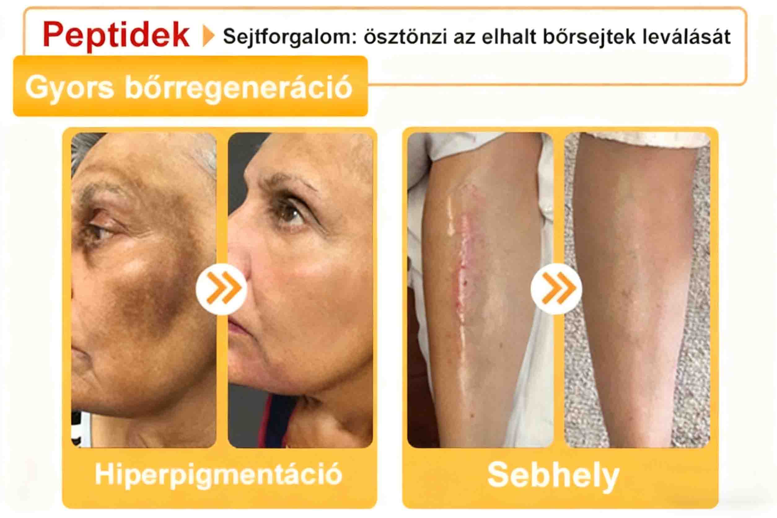 🔥𝐀𝐕𝐒𝐀𝐕𝐒™ 𝐌é𝐡𝐦é𝐫𝐞𝐠 𝐁ő𝐫𝐡𝐞𝐥𝐲𝐫𝐞á𝐥𝐥í𝐭ó 𝐊𝐫é𝐦 (👨‍⚕‍𝐂𝐄 𝐣ó𝐯á𝐡𝐚𝐠𝐲𝐨𝐭𝐭)