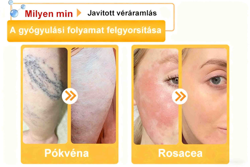 🔥𝐀𝐕𝐒𝐀𝐕𝐒™ 𝐌é𝐡𝐦é𝐫𝐞𝐠 𝐁ő𝐫𝐡𝐞𝐥𝐲𝐫𝐞á𝐥𝐥í𝐭ó 𝐊𝐫é𝐦 (👨‍⚕‍𝐂𝐄 𝐣ó𝐯á𝐡𝐚𝐠𝐲𝐨𝐭𝐭)