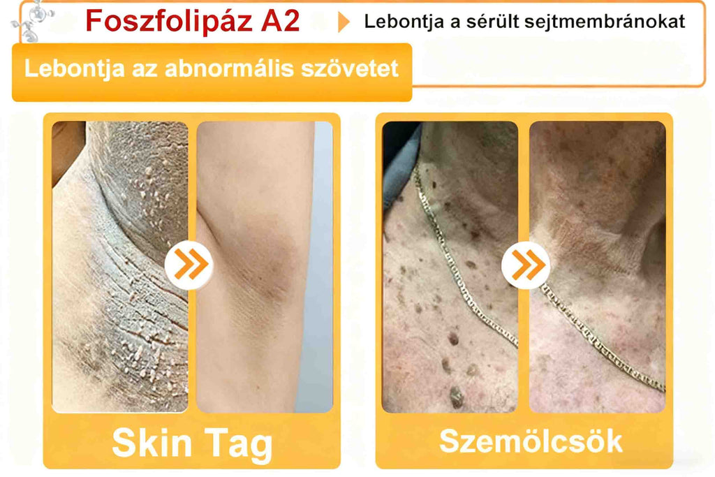 🔥𝐀𝐕𝐒𝐀𝐕𝐒™ 𝐌é𝐡𝐦é𝐫𝐞𝐠 𝐁ő𝐫𝐡𝐞𝐥𝐲𝐫𝐞á𝐥𝐥í𝐭ó 𝐊𝐫é𝐦 (👨‍⚕‍𝐂𝐄 𝐣ó𝐯á𝐡𝐚𝐠𝐲𝐨𝐭𝐭)