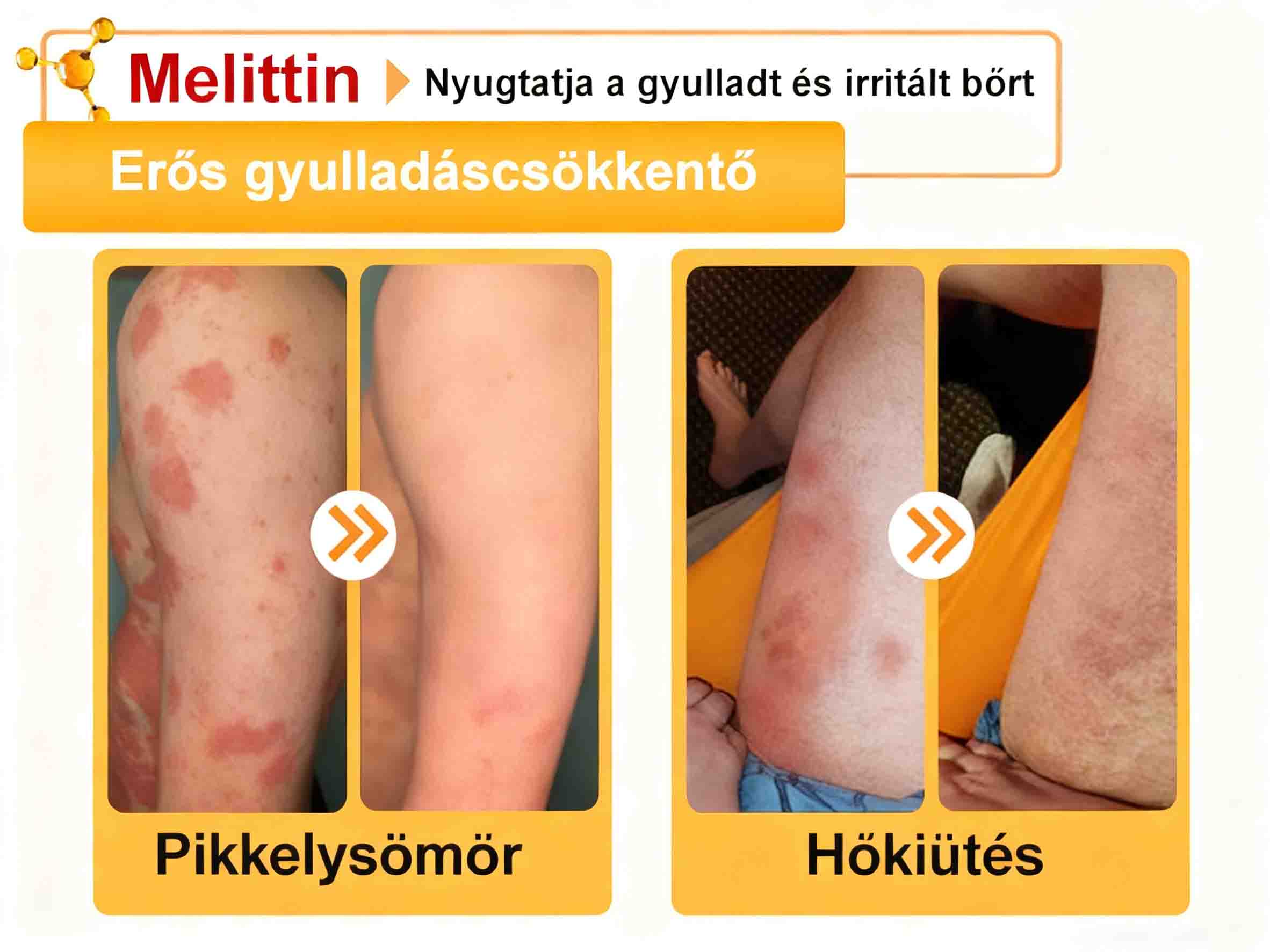 ⭐𝐀𝐕𝐒𝐀𝐕𝐒™ 𝐌é𝐡𝐦é𝐫𝐞𝐠 𝐁ő𝐫𝐡𝐞𝐥𝐲𝐫𝐞á𝐥𝐥í𝐭ó 𝐊𝐫é𝐦 (👨‍⚕‍𝐂𝐄 𝐣ó𝐯á𝐡𝐚𝐠𝐲𝐨𝐭𝐭)