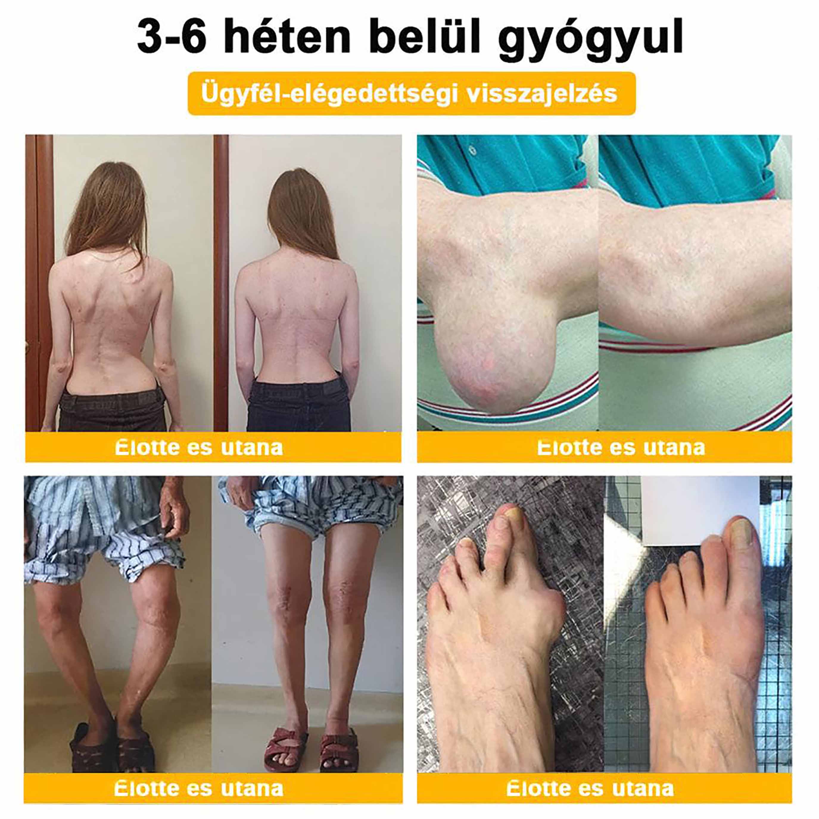 ✨ARTART™ Méhméreg Fájdalomcsillapító Csontregeneráló Krém (Kifejezetten ízületi fájdalmakkal küzdő betegek számára tervezve, szakértők ajánlásával)