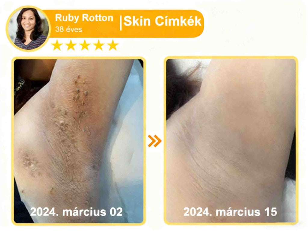 🔥𝐀𝐕𝐒𝐀𝐕𝐒™ 𝐌é𝐡𝐦é𝐫𝐞𝐠 𝐁ő𝐫𝐡𝐞𝐥𝐲𝐫𝐞á𝐥𝐥í𝐭ó 𝐊𝐫é𝐦 (👨‍⚕‍𝐂𝐄 𝐣ó𝐯á𝐡𝐚𝐠𝐲𝐨𝐭𝐭)