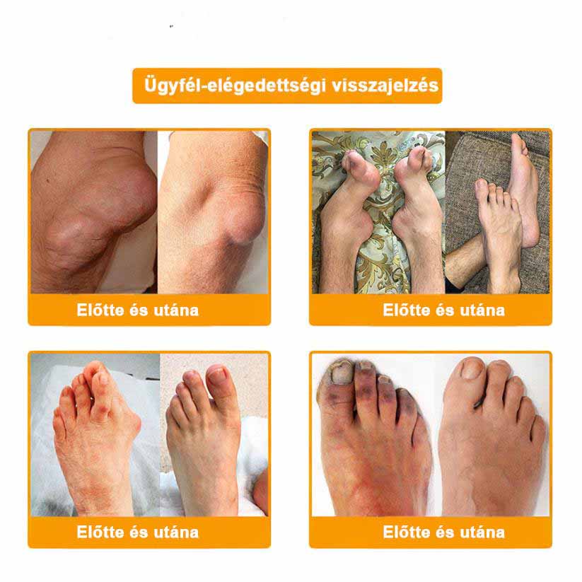 ✨ARTART™ Méhméreg Fájdalomcsillapító Csontregeneráló Krém (Kifejezetten ízületi fájdalmakkal küzdő betegek számára tervezve, szakértők ajánlásával)