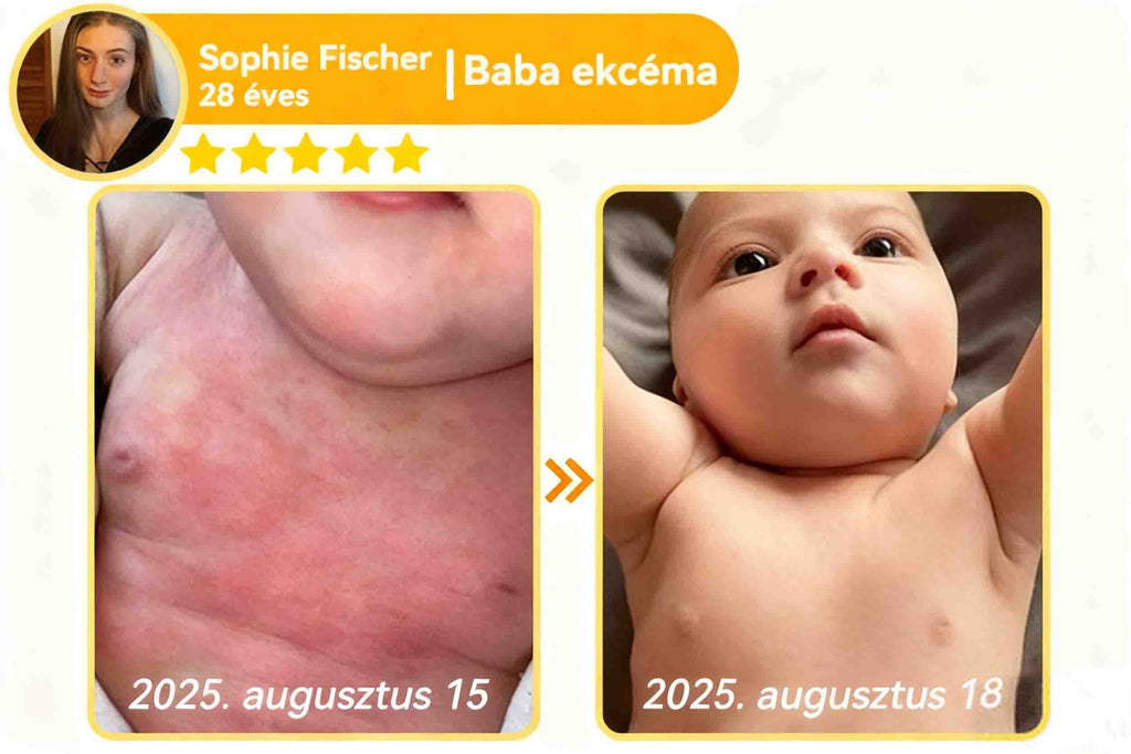 🔥𝐀𝐕𝐒𝐀𝐕𝐒™ 𝐌é𝐡𝐦é𝐫𝐞𝐠 𝐁ő𝐫𝐡𝐞𝐥𝐲𝐫𝐞á𝐥𝐥í𝐭ó 𝐊𝐫é𝐦 (👨‍⚕‍𝐂𝐄 𝐣ó𝐯á𝐡𝐚𝐠𝐲𝐨𝐭𝐭)