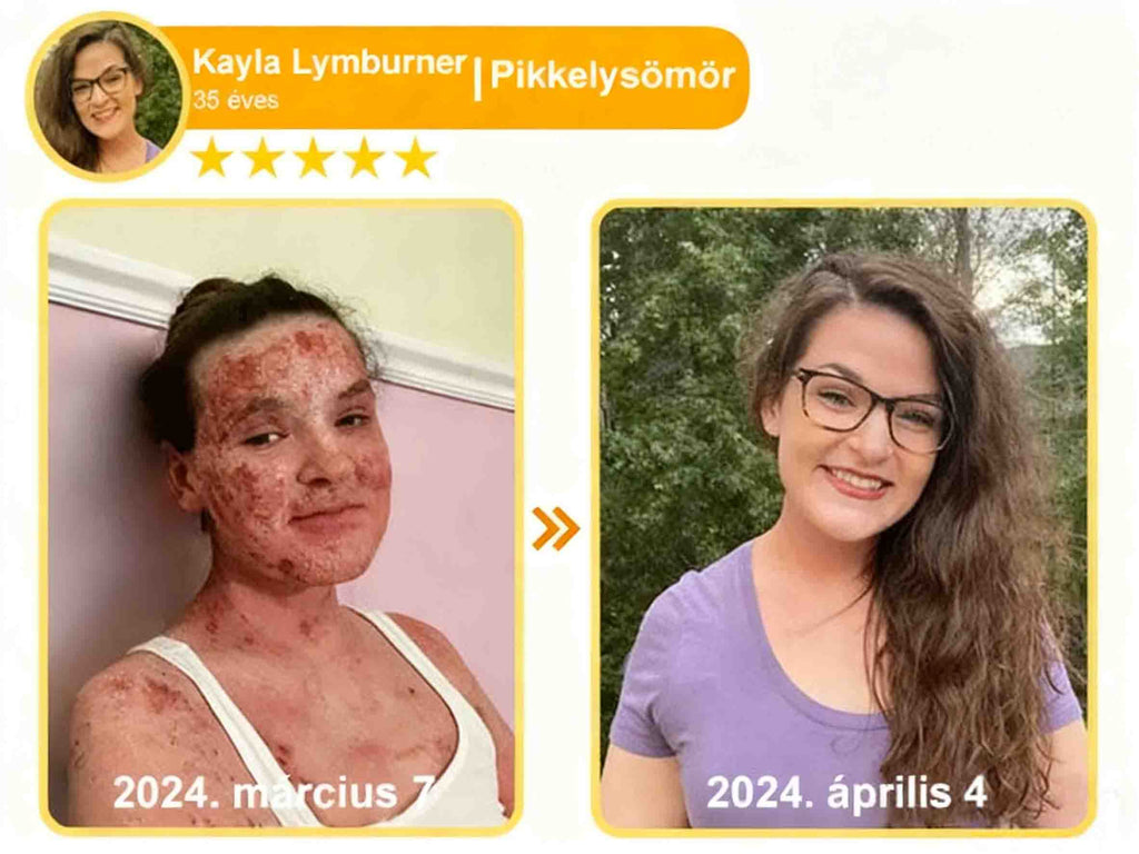 🔥𝐀𝐕𝐒𝐀𝐕𝐒™ 𝐌é𝐡𝐦é𝐫𝐞𝐠 𝐁ő𝐫𝐡𝐞𝐥𝐲𝐫𝐞á𝐥𝐥í𝐭ó 𝐊𝐫é𝐦 (👨‍⚕‍𝐂𝐄 𝐣ó𝐯á𝐡𝐚𝐠𝐲𝐨𝐭𝐭)