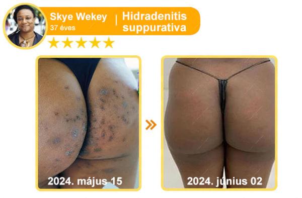 🔥𝐀𝐕𝐒𝐀𝐕𝐒™ 𝐌é𝐡𝐦é𝐫𝐞𝐠 𝐁ő𝐫𝐡𝐞𝐥𝐲𝐫𝐞á𝐥𝐥í𝐭ó 𝐊𝐫é𝐦 (👨‍⚕‍𝐂𝐄 𝐣ó𝐯á𝐡𝐚𝐠𝐲𝐨𝐭𝐭)